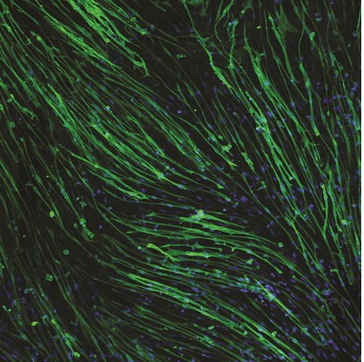 Muscle cells