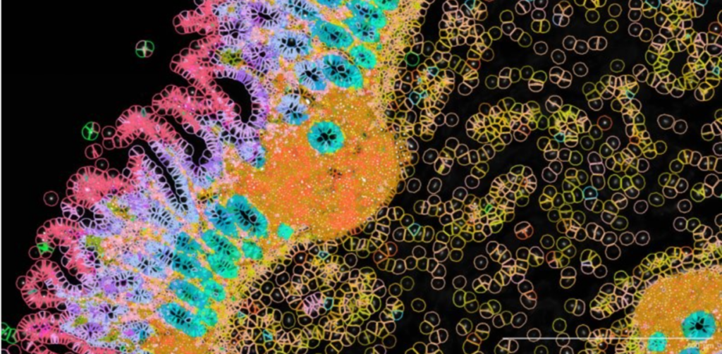 Spatial map of cells within tissue - 10x Xenium